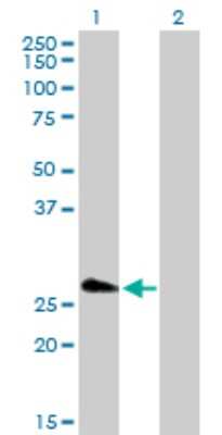 Western Blot: FHL5 Antibody [H00009457-D01P]
