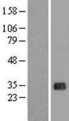 Western Blot: FHL5 Overexpression Lysate [NBL1-10717]
