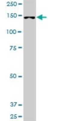 Western Blot: FHOD1 Antibody [H00029109-B01P]