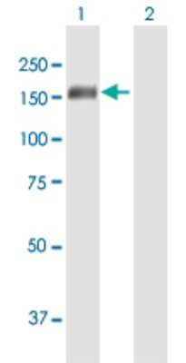 Western Blot: FHOD1 Antibody [H00029109-B01P]