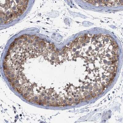 Immunohistochemistry-Paraffin: FHOD3 Antibody [NBP1-83898]