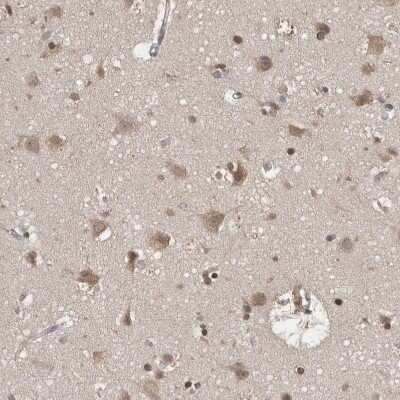 Immunohistochemistry-Paraffin: FHOD3 Antibody [NBP1-83899]
