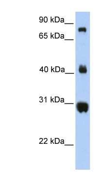 Western Blot: FIBCD1 Antibody [NBP1-91362]