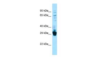 Western Blot: FIBCD1 Antibody [NBP2-87441]