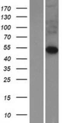 Western Blot: FIBCD1 Overexpression Lysate [NBP2-05944]
