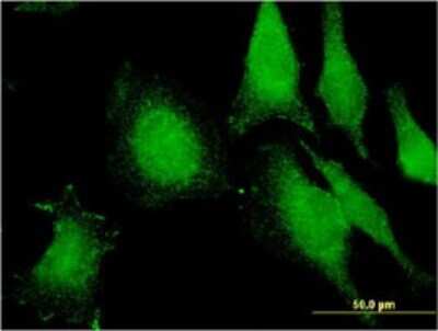 Immunocytochemistry/ Immunofluorescence: FIBP Antibody (1E5) [H00009158-M01]