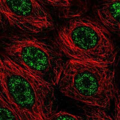 Immunocytochemistry/ Immunofluorescence: FIBP Antibody [NBP1-83903]