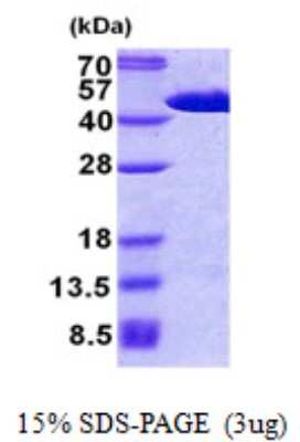 SDS-PAGE: Recombinant Human FIBP His Protein [NBP2-23049]