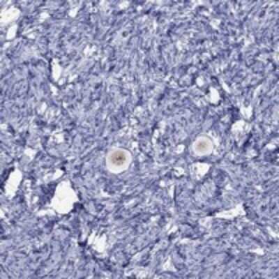 Immunohistochemistry-Paraffin: FIGLA Antibody [NBP3-17250]