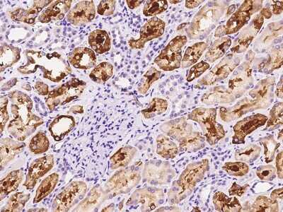 Immunohistochemistry-Paraffin: FIGNL1 Antibody [NBP2-97167]