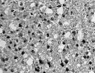 Immunohistochemistry: FIH-1/HIF-1AN Antibody [NB100-428]