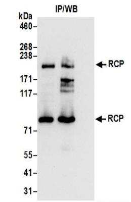 Immunoprecipitation: FIP1/RCP Antibody [NBP2-37699]