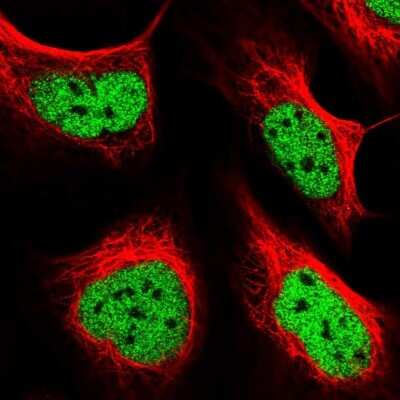Immunocytochemistry/ Immunofluorescence: FIP1L1 Antibody [NBP1-85064]