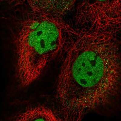 Immunocytochemistry/ Immunofluorescence: FIP1L1 Antibody [NBP2-55078]