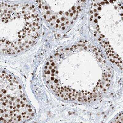 Immunohistochemistry-Paraffin: FIP1L1 Antibody [NBP1-85064]