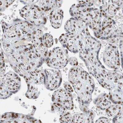 Immunohistochemistry-Paraffin: FIP1L1 Antibody [NBP1-85064]