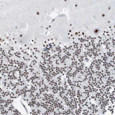 Immunohistochemistry-Paraffin: FIP1L1 Antibody [NBP1-85064]