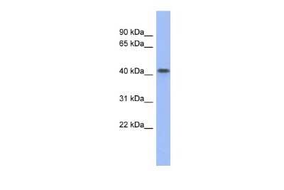Western Blot: FIZ1 Antibody [NBP2-82794]