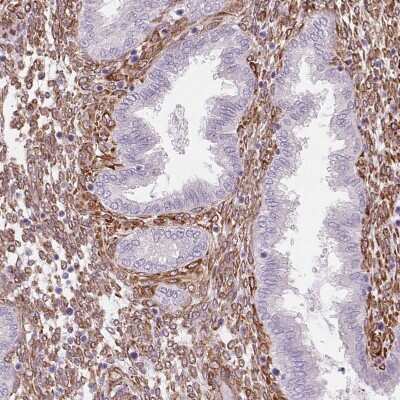 Immunohistochemistry-Paraffin: FKBP10 Antibody [NBP2-49242]