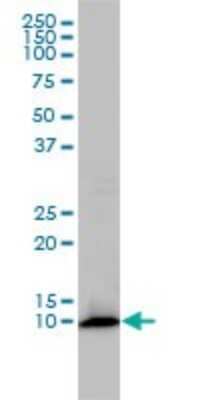 Western Blot: FKBP12 Antibody (1E5-A12) [H00002280-M01]