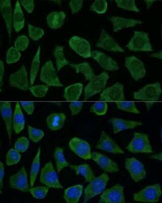 Immunocytochemistry/ Immunofluorescence: FKBP12.6 Antibody - Azide and BSA Free [NBP3-02968]