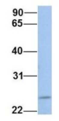 Western Blot: FKBP25 Antibody [NBP1-54354]