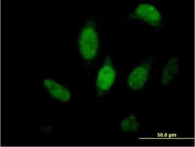 Immunocytochemistry/ Immunofluorescence: FKBP51/FKBP5 Antibody [H00002289-B01P]