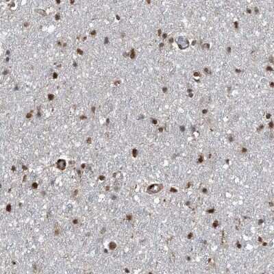 Immunohistochemistry-Paraffin: FKBP51/FKBP5 Antibody [NBP1-84677]