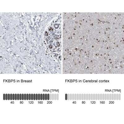 Immunohistochemistry-Paraffin: FKBP51/FKBP5 Antibody [NBP1-84677]