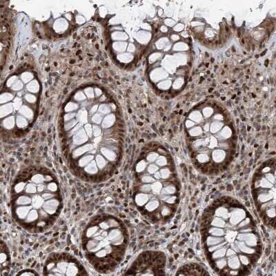 Immunohistochemistry-Paraffin: FKBP51/FKBP5 Antibody [NBP2-33944]