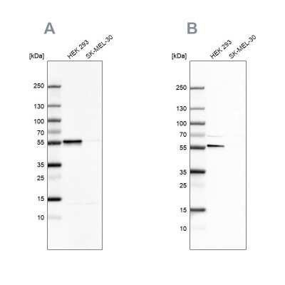 Western Blot: FKBP51/FKBP5 Antibody [NBP1-84676]