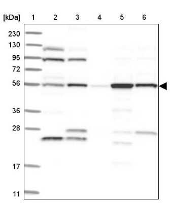 Western Blot: FKBP51/FKBP5 Antibody [NBP2-33944]