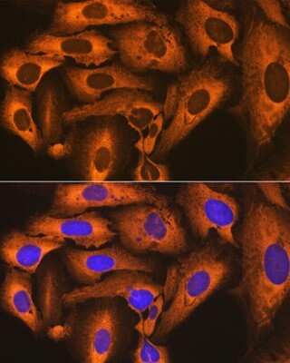 Immunocytochemistry/ Immunofluorescence: FKBP52/FKBP4 Antibody (3Q6H2) [NBP3-16387]