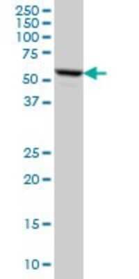 Western Blot: FKBP52/FKBP4 Antibody (5C11) [H00002288-M01]