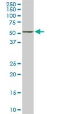 Western Blot: FKBP52/FKBP4 Antibody (5C11) [H00002288-M01]