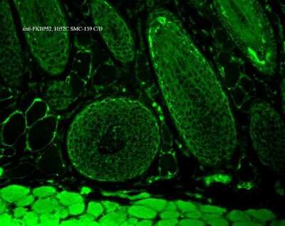 Immunohistochemistry: FKBP52/FKBP4 Antibody (Hi52C) [NB110-96874]