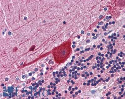Immunohistochemistry-Paraffin: FKBP52/FKBP4 Antibody [NBP1-18845]