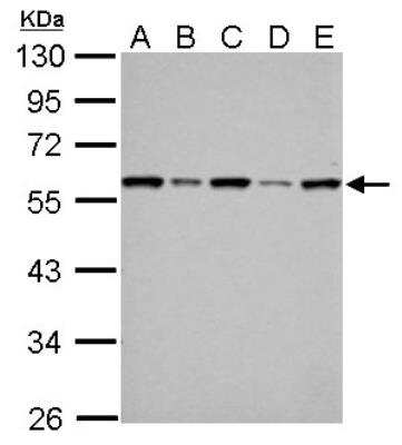 Western Blot: FKBP52/FKBP4 Antibody [NBP1-33702]