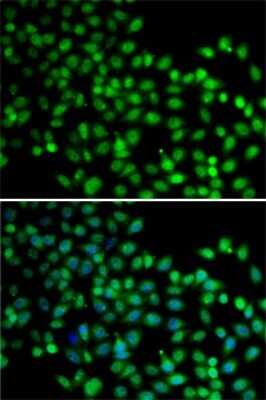 Immunocytochemistry/ Immunofluorescence: FKBP6 Antibody - BSA Free [NBP3-04676]