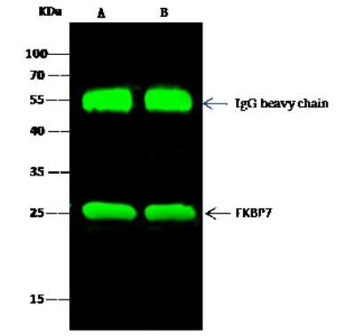 Immunoprecipitation: FKBP7 Antibody [NBP2-99915]