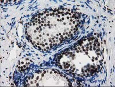 Immunohistochemistry-Paraffin: FKBPL Antibody (OTI2D8) [NBP2-03407]