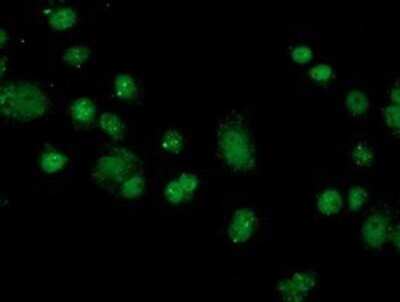 Immunocytochemistry/ Immunofluorescence: FKBPL Antibody (OTI2D8) - Azide and BSA Free [NBP2-72125]