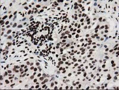Immunohistochemistry: FKBPL Antibody (OTI2D8) - Azide and BSA Free [NBP2-72125]