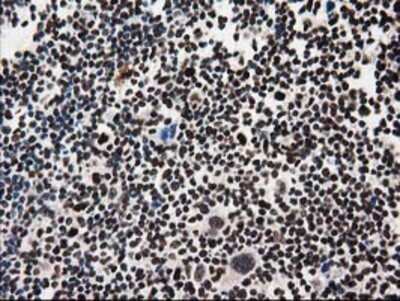 Immunohistochemistry: FKBPL Antibody (OTI2D8) - Azide and BSA Free [NBP2-72125]