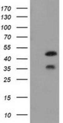 Western Blot: FKBPL Antibody (OTI2D8)Azide and BSA Free [NBP2-72125]