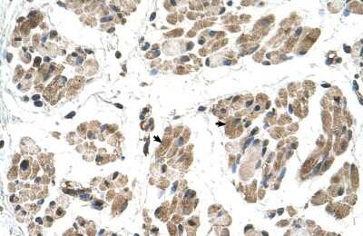 Immunohistochemistry-Paraffin: FKTN Antibody [NBP1-59640]