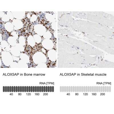 Immunohistochemistry-Paraffin: FLAP Antibody [NBP1-84666]