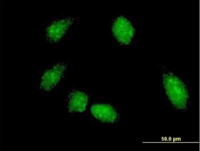 Immunocytochemistry/ Immunofluorescence: FLI1 Antibody (1F6) [H00002313-M05]