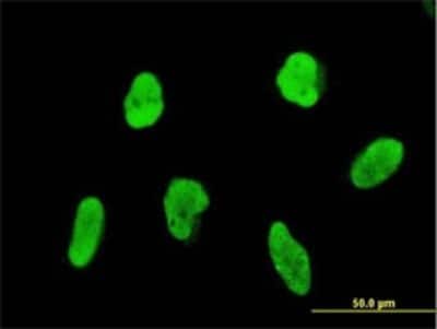 Immunocytochemistry/ Immunofluorescence: FLI1 Antibody (1G8) [H00002313-M01]