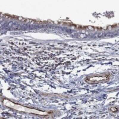 Immunohistochemistry-Paraffin: FLI1 Antibody [NBP3-17205]